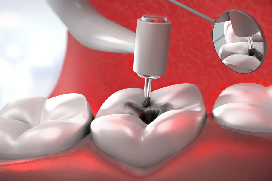 iStock-500800304-web2