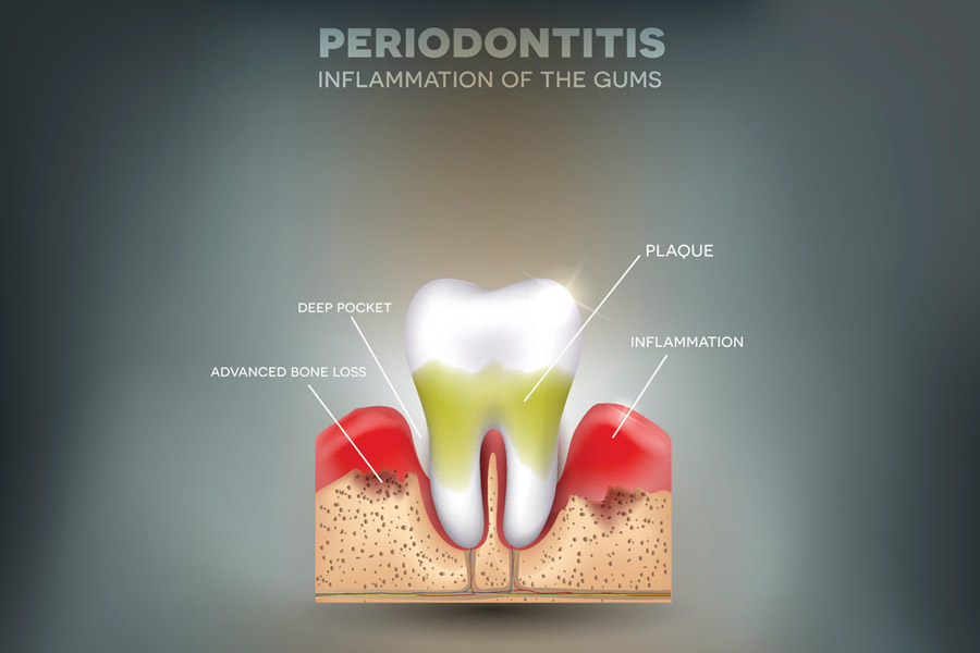 iStock-653478082-web2